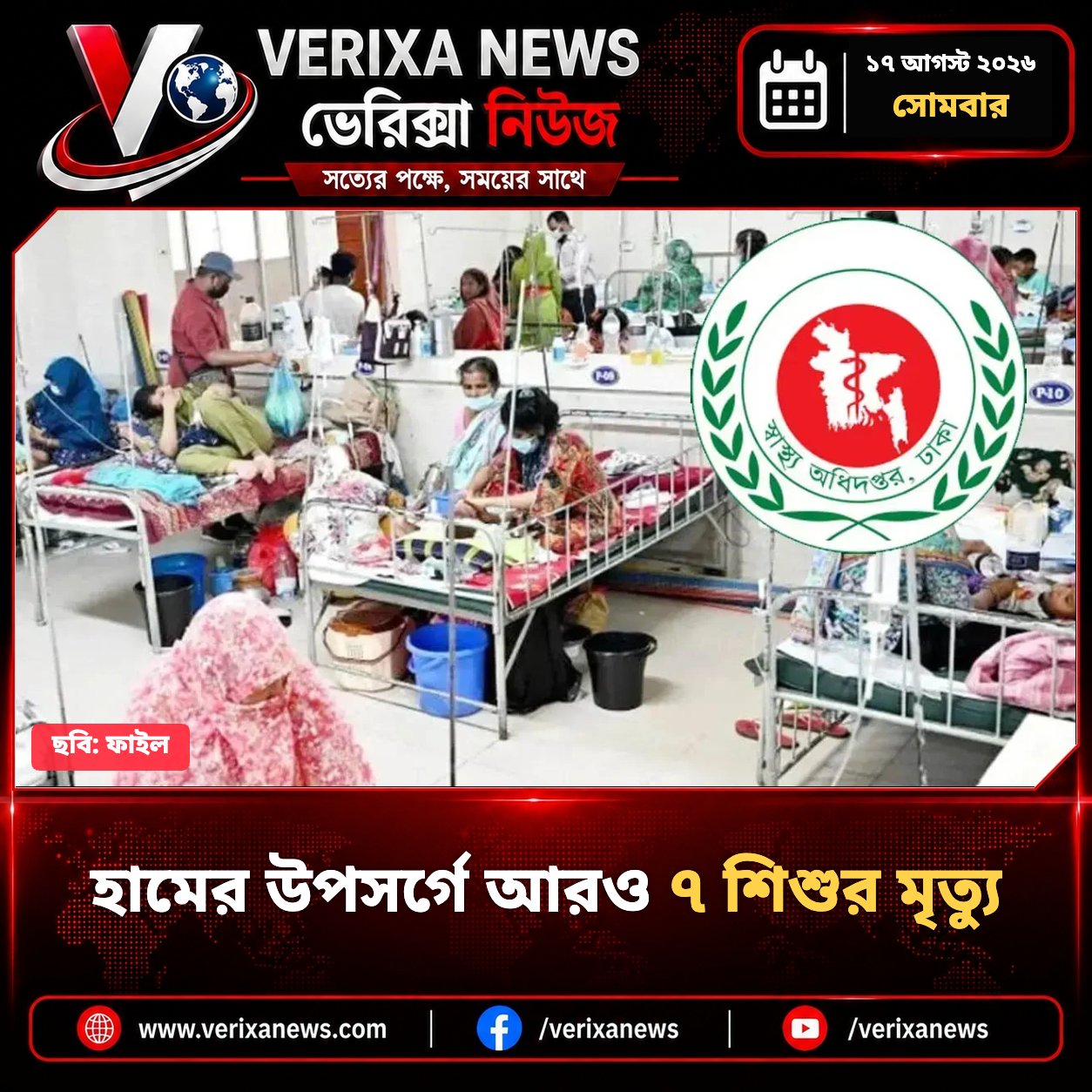 হামের উপসর্গে আরও ৭ শিশুর মৃত্যু — 1
